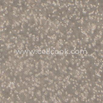 OCI-LY8人彌漫性大B細(xì)胞淋巴瘤（物種鑒定正確）