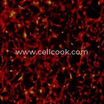 U-87 MG-RFP示蹤穩(wěn)定細胞株（STR鑒定正確）