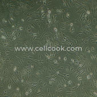 SW1088人腦星形膠質(zhì)細(xì)胞瘤細(xì)胞（STR鑒定正確）