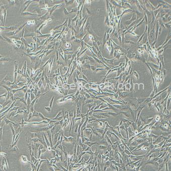 SW1783人腦星形膠質(zhì)細(xì)胞瘤細(xì)胞（STR鑒定正確）