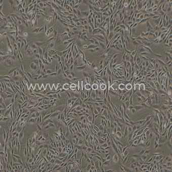 CCF-STTG1人腦星形膠質(zhì)細(xì)胞瘤細(xì)胞（STR鑒定正確）