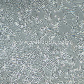 HS683人腦膠質(zhì)瘤細胞（STR鑒定正確）