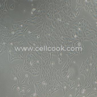 T98G人腦膠質(zhì)母細胞瘤（STR鑒定正確）