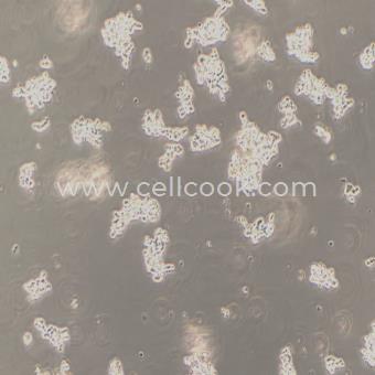 Y79人視網(wǎng)膜母細胞瘤（STR鑒定正確）