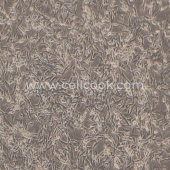 LN-464人腦星形膠質(zhì)細胞瘤細胞（STR鑒定正確）