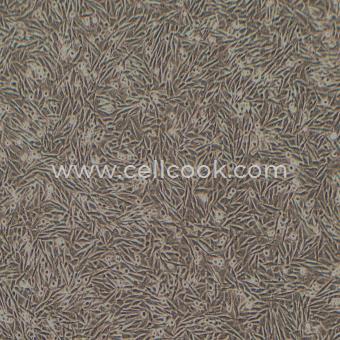 A2058人無(wú)黑素性黑色素瘤（淋巴轉(zhuǎn)移）（STR鑒定正確）