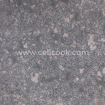 Mel270人脈絡(luò)膜黑色素瘤細(xì)胞（STR鑒定正確）