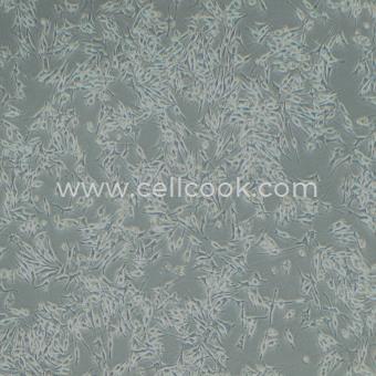 Mel202-LUC示蹤穩(wěn)定細(xì)胞株（STR鑒定正確）