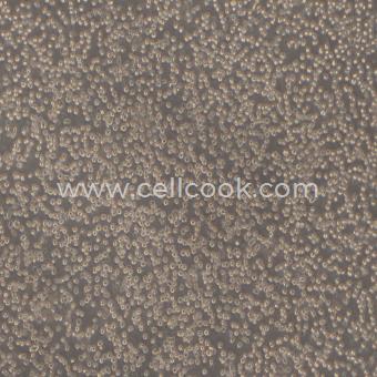 MOLT-4人急性淋巴母細(xì)胞性白血病細(xì)胞（STR鑒定正確）