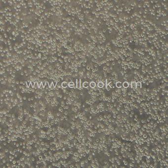 KG-1a人髓系白血病細(xì)胞（STR鑒定正確）