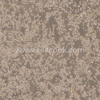 HEL人紅白細(xì)胞白血病細(xì)胞（STR鑒定正確）