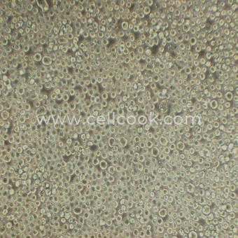 Kasumi-1人急性髓母白血病細(xì)胞（STR鑒定正確）