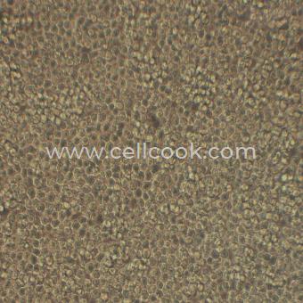 NB-4人急性早幼粒白血病細(xì)胞（STR鑒定正確）