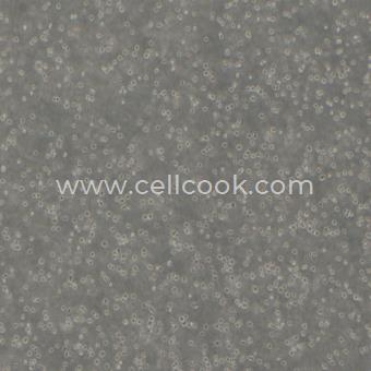 NALM6 B系急性淋巴細(xì)胞白血病細(xì)胞（STR鑒定正確）