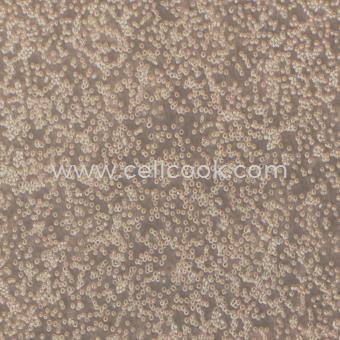 MV-4-11人髓性單核細(xì)胞白血病細(xì)胞（STR鑒定正確）