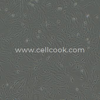 SW1353人骨肉瘤細(xì)胞（STR鑒定正確）