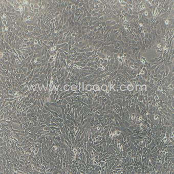 143B人骨肉瘤細(xì)胞（STR鑒定正確）