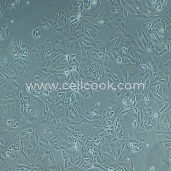 SAOS-2人成骨肉瘤細(xì)胞（STR鑒定正確）