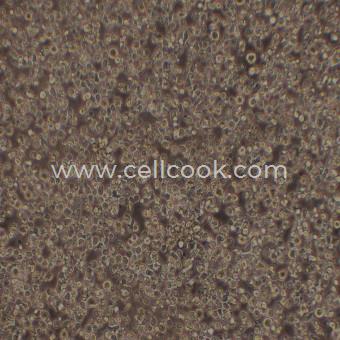 BA/F3小鼠原B細(xì)胞（STR鑒定正確）