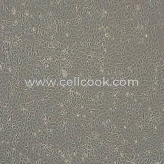 IEC-6大鼠小腸隱窩上皮細(xì)胞（種屬鑒定正確）