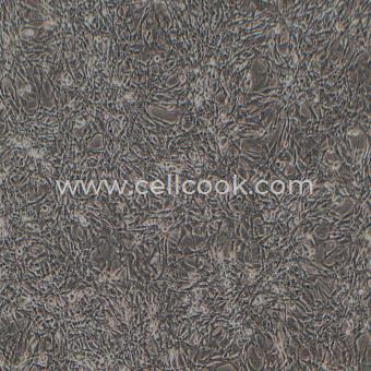 HBZY-1大鼠腎小球系膜細(xì)胞（種屬鑒定正確）