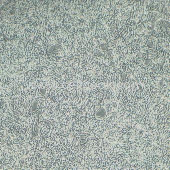 MC38 小鼠結(jié)腸癌細(xì)胞(STR鑒定正確)