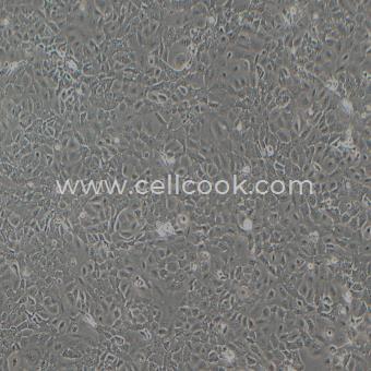 HC11小鼠乳腺上皮細(xì)胞