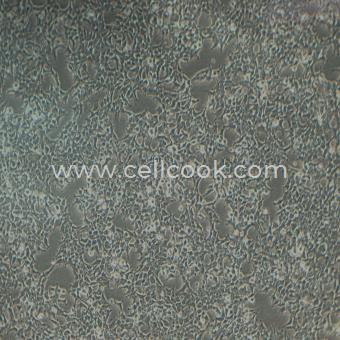 293T/17SV40T轉(zhuǎn)化的人胚腎細(xì)胞（STR鑒定正確）