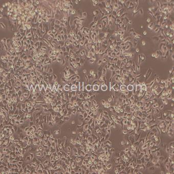 KB 人口腔表皮癌細胞