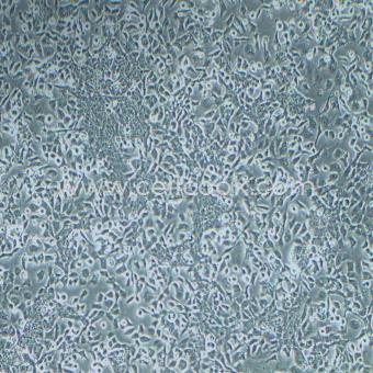 NCI-H446人小細(xì)胞肺癌細(xì)胞（STR鑒定正確）