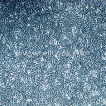 NCI-H1666人肺支氣管癌細(xì)胞（STR鑒定正確）