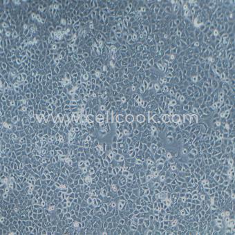 SW780人膀胱移行細(xì)胞癌細(xì)胞（STR鑒定正確）