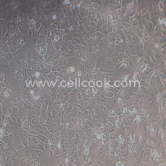 BHT-101人甲狀腺癌細(xì)胞（退行性）（STR鑒定正確）