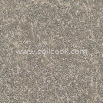 HT-29-LUC示蹤穩(wěn)定細(xì)胞株（STR鑒定正確）