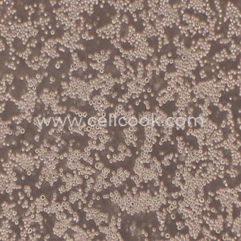 P3/NSI/1-Ag4-1 [NS-1]小鼠骨髓瘤細(xì)胞（種屬鑒定正確）