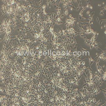 PLA-801D(95D)人高轉(zhuǎn)移肺腺癌細(xì)胞（STR鑒定正確）