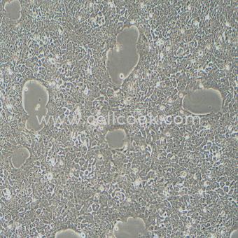 Kyse-140人食管鱗癌細(xì)胞（STR鑒定正確）