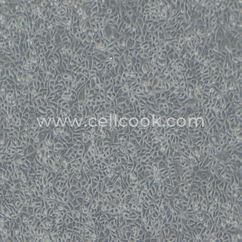 NPC/HK1人鼻咽癌細(xì)胞（STR鑒定正確）