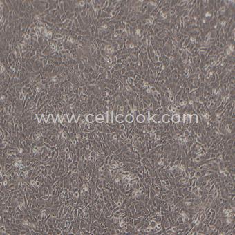 SN12C人腎癌細(xì)胞（STR鑒定正確）