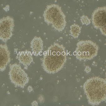 MT-4人T細(xì)胞白血病細(xì)胞（STR鑒定正確）