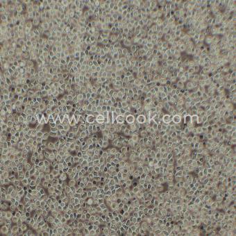 HAL-01人急性淋巴細(xì)胞白血病細(xì)胞（STR鑒定正確）