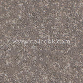 HuTu-80人十二指腸腺癌細胞（STR鑒定正確）