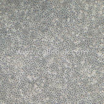 Hela-LUC示蹤穩(wěn)定細(xì)胞株（STR鑒定正確）