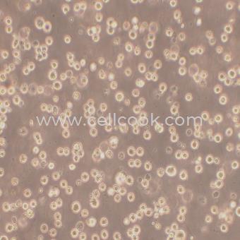 K562-DDP人慢性髓原白血病細(xì)胞順鉑耐藥株（STR鑒定正確）