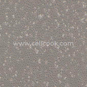 HMEC-1人微血管內(nèi)皮細(xì)胞（STR鑒定正確）