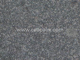 293A人胚腎細胞（STR鑒定正確）